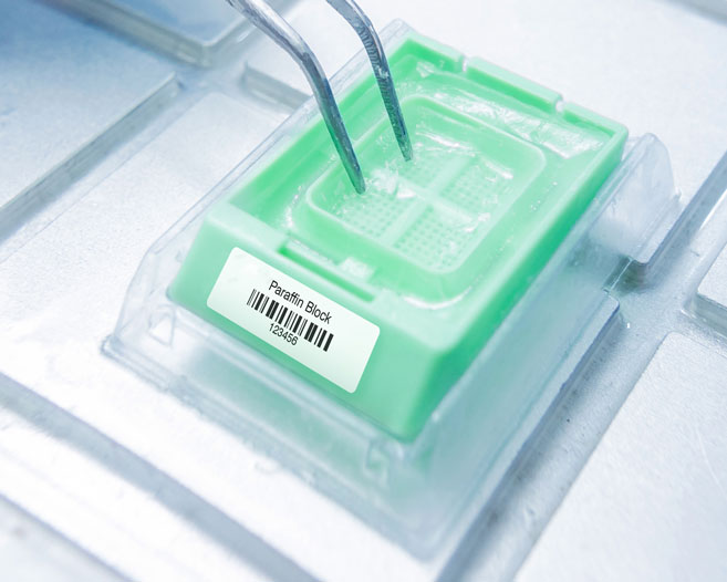 Barcode Labeled paraffin block cassette in a lab