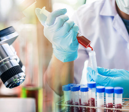 Laboratory technician wearing blue gloves gets blood filled test tubes ready for HIV testing.