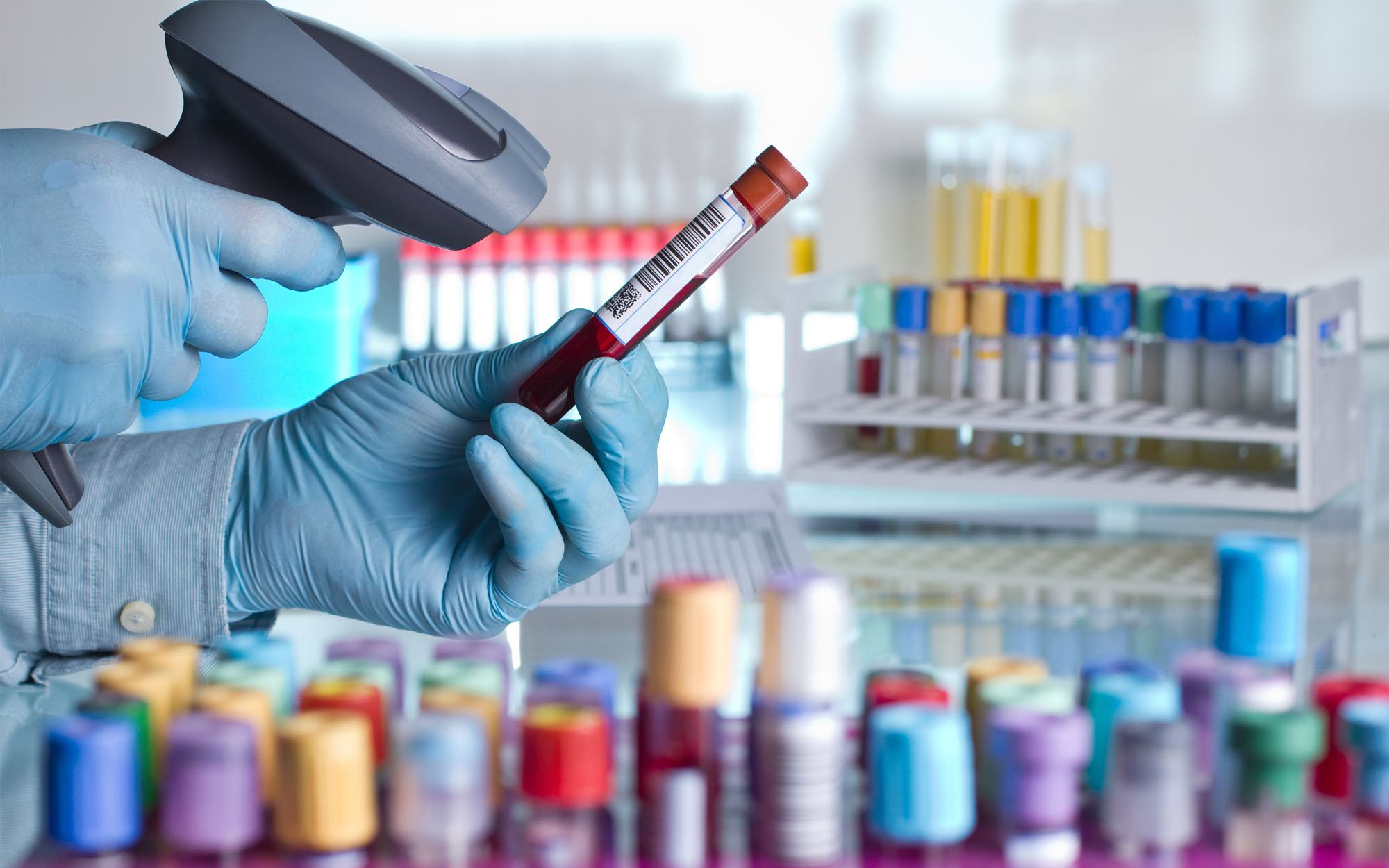 Five Ways to Make Laboratory Labeling Easier